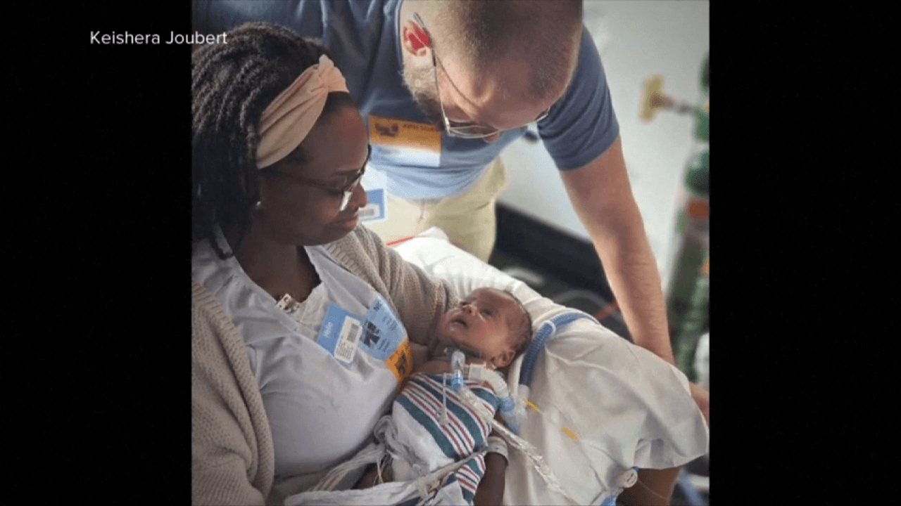 Orlando family celebrates after their baby is born twice through life-saving surgery